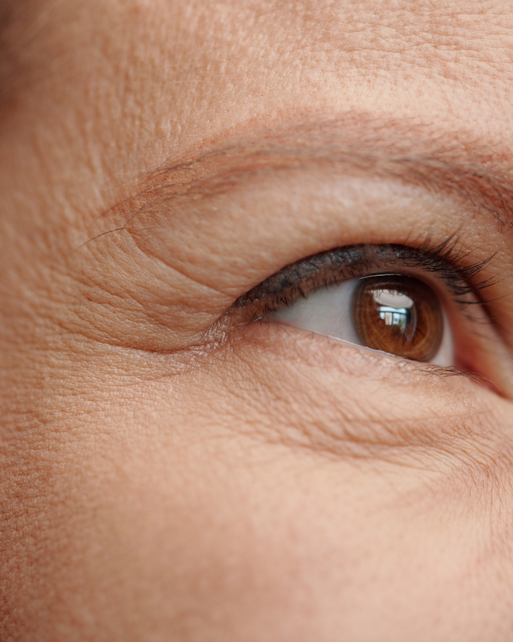 Fine Lines & Wrinkles