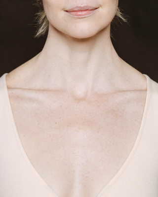 Neck & Décolletage
