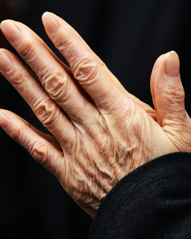 Skin Laxity (Face, Neck, Body)