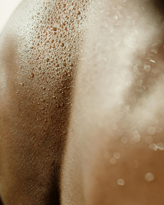 Sweat Reduction (Hyperhidrosis)